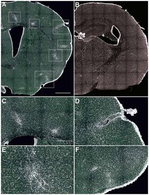 Clonal Glial Response in a Multiple Sclerosis Mouse Model